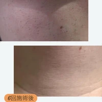 画像338