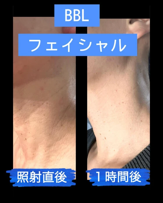 画像346