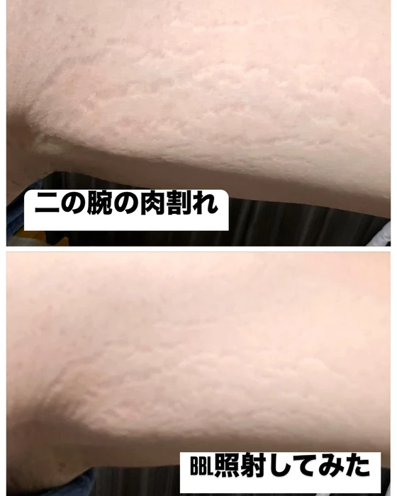 画像495