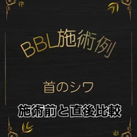 画像537