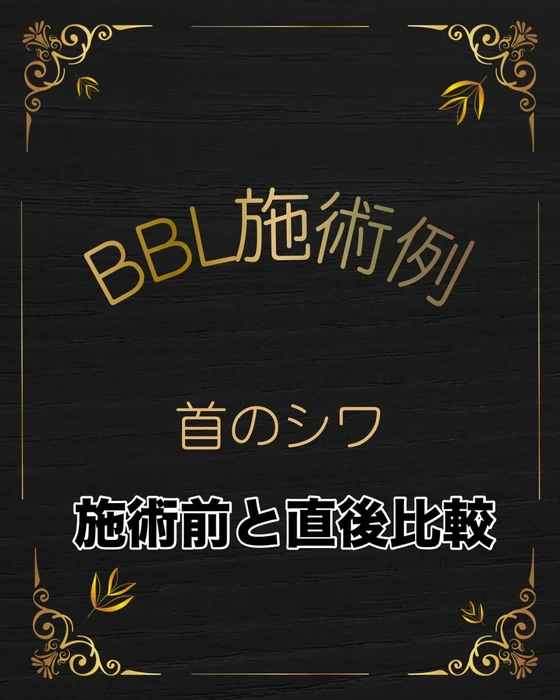 画像537