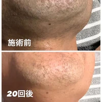 画像581